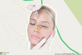 בוטוקס בפקיעין